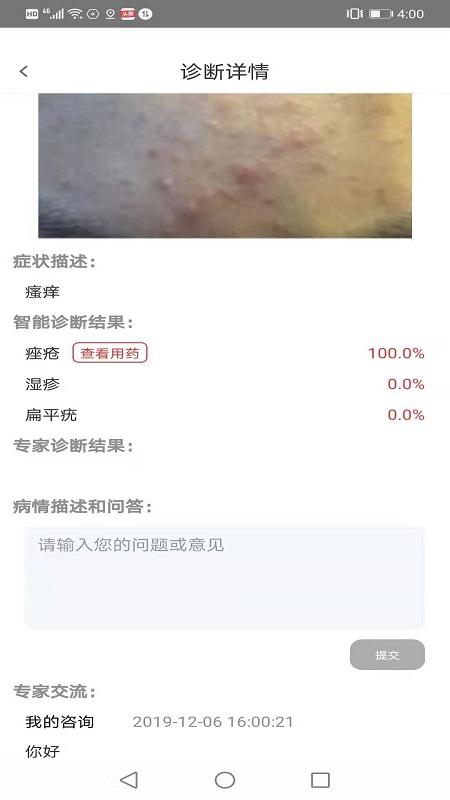 拍一拍识别皮肤病 (拍一拍识别皮肤病软件 )